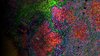 Multiplex-Immunfluoreszenz-Bildgebung  