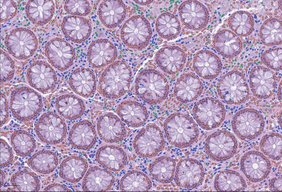 Zelldetektion mit LazySlide in menschlichem Dickdarmgewebe: Immunzellen (grün), Bindegewebszellen (blau) und Epithelzellen (orange) Zelldetektion mit LazySlide in menschlichem Dickdarmgewebe: Immunzellen (grün), Bindegewebszellen (blau) und Epithelzellen (orange)