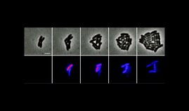 Zeitraffer-Mikroskopieaufnahmen einer wachsenden Sinorhizobium meliloti-Kolonie