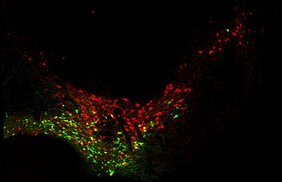 dopaminergen Neuronen des Mittelhirns Nervenzellen