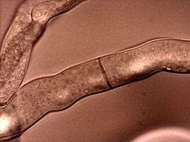Neurospora crassa, Bild: Roland Gromes, Wikimedia Commons CC BY-SA 3.0