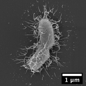 Rasterelektronenmikroskopische Aufnahme des Darmbakteriums Prevotella rodentium. Die Spezies wurde in der Studie isoliert. 