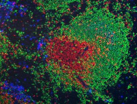 Immunfluoreszenzfärbung von T-Zellen (rot), B-Zellen (grün) und IgG1-positiven B-Zellen/Plasmazellen (blau) in der Milz einer immunisierten Maus.