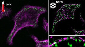 Fluoreszenzmikroskopie eines Onkoproteins