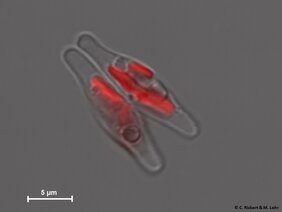 Zwei Zellen der Kieselalge Phaeodactylum tricornutum, deren Plastiden durch die Rotfluoreszenz der darin enthaltenen Fotosynthesepigmente (Chlorophylle) erkennbar sind. 
