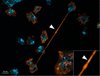 Die mikroskopische Aufnahme zeigt Amöbenzellen, die über Tunnel-Nanoröhrchen miteinander verbunden sind 