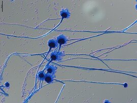 Sporenträger von Aspergillus fumigatus