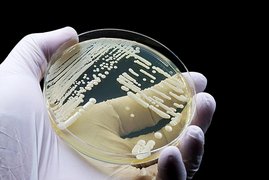 Eine mikrobiologische Kultur des Hefepilzes Candida auris, der Infektionen verursachen kann. Eine mikrobiologische Kultur des Hefepilzes Candida auris, der Infektionen verursachen kann.