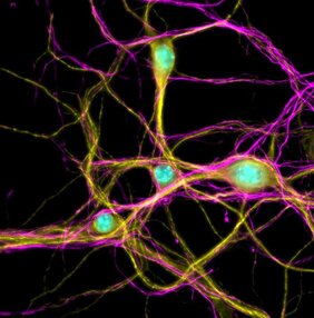 Primary cortical neuron 