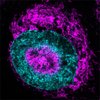 Das Innere einer gequetschten Krebszelle, in der sich die Mitochondrien (pink) außen am Zellkern (cyan) und in „Vertiefungen” des Zellkerns ansammeln. 