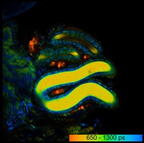 Falschfarbenbild der Fluoreszenz-Lebenszeit des Stoffwechselmoleküls NADH eines Spermienhaufens (hier gelb) in einem weiblichen Spermienspeicherorgan in der Taufliege.