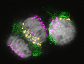 Mitotische Zellen während der Eliminierung von B Chromosomen  