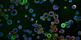 Lung organoids Covid