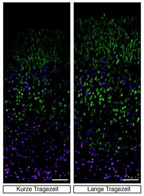 Nervenzellen in den tiefen (Magenta) und oberen (grün) Neokortex-Schichten bei Mäusen mit kurzer (links) und langer (rechts) Tragezeit. 