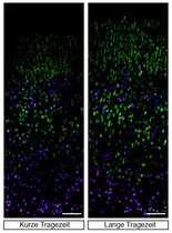 Nervenzellen in den tiefen (Magenta) und oberen (grün) Neokortex-Schichten bei Mäusen mit kurzer (links) und langer (rechts) Tragezeit. 