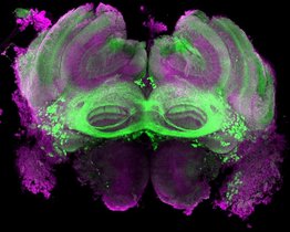 Mikroskopblick ins Drohnengehirn (violett): grün markiert sind die Neuronen, die zum Fru-Schaltkreis gehören und die das Verhalten bei der Futteraufnahme der Tiere steuern. Mikroskopblick ins Drohnengehirn (violett): grün markiert sind die Neuronen, die zum Fru-Schaltkreis gehören und die das Verhalten bei der Futteraufnahme der Tiere steuern.