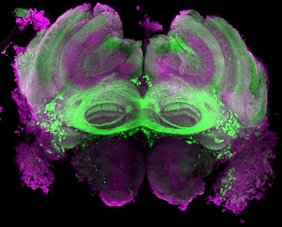 Mikroskopblick ins Drohnengehirn (violett): grün markiert sind die Neuronen, die zum Fru-Schaltkreis gehören und die das Verhalten bei der Futteraufnahme der Tiere steuern.  