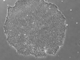 Humane pluripotente Stammzellen  