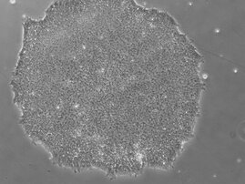 Humane pluripotente Stammzellen  