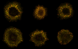 Mikroskopaufnahmen von Zellen, in denen Aktinfasen des Zellskeletts gelb und fokale Adhäsionen pink gefärbt sind.