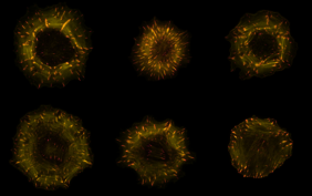 Mikroskopaufnahmen von Zellen, in denen Aktinfasen des Zellskeletts gelb und fokale Adhäsionen pink gefärbt sind.