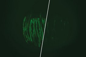 C. elegans-Würmer zeigen in dem links abgebildeten Krankheitsmodell eine Stressreaktion, die grün zu sehen ist C. elegans-Würmer zeigen in dem links abgebildeten Krankheitsmodell eine Stressreaktion, die grün zu sehen ist