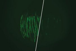 C. elegans-Würmer zeigen in dem links abgebildeten Krankheitsmodell eine Stressreaktion, die grün zu sehen ist