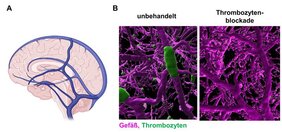 Schematische Darstellung der großen Hirnvenen