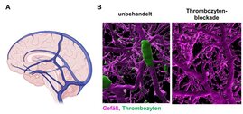 Schematische Darstellung der großen Hirnvenen