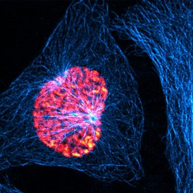 Eine kultivierte menschliche Zelle (HeLa-Zelle) in der Prophase. Chromosomen sind in Rottönen dargestellt, Mikrotubuli sind blau markiert. 