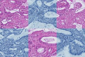Histologisches Präparat mit Rot- und Blau-Färbung