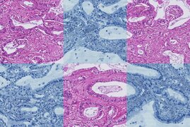 Histologisches Präparat mit Rot- und Blau-Färbung