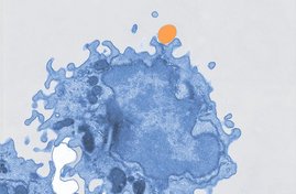 Pseudokoloriertes Elektronenmikroskopiebild einer Makrophage (blau), die Mikroplastik (orange) aufnimmt Pseudokoloriertes Elektronenmikroskopiebild einer Makrophage (blau), die Mikroplastik (orange) aufnimmt