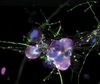 Die Aufnahme zeigt generierte patienteneigene Nervenzellen in grün. Der Zellkern ist bau dargestellt und der TRPA1 Kanal in Magenta.