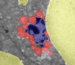 Das Bild zeigt den Querschnitt des mutierten braunen Fettgewebes mit vergrößerten Lipidtröpfchen (gelb) und einem Zellkern (blau), der von mehreren Mitochondrien (rot) umgeben ist.