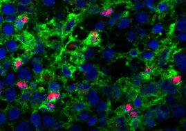 Ein Team am MDC hat eine bisher unerwartete Rolle des Transkriptionsfaktors C/EBP bei der Reifung und immunogenen Funktionalität von dendritischen Zellen (in rot) der Maus