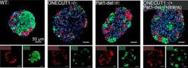 zellen, Pankreasinseln wurden im Labor aus Stammzellen generiert, die die Mutationen des Patienten tragen