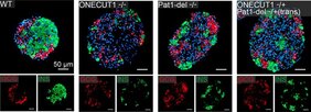 zellen, Pankreasinseln wurden im Labor aus Stammzellen generiert, die die Mutationen des Patienten tragen