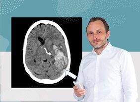 Professor Dr. Andreas Tiede mit der computertomographischen Aufnahme einer VITT-Patientin.