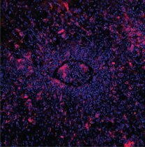 Lebergewebe von Mäusen, die als Modell für die seltene Immunerkrankung FHL dienen