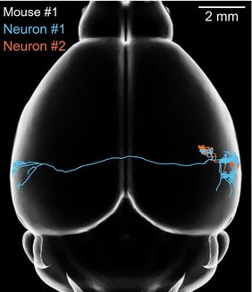 Zwei beim Tonhören gleichzeitig aktive Nervenzellen 