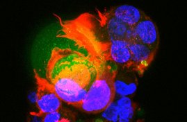 Krebszellen (rot und blau) binden eng an eine synthetische Immunzelle (grün). Es entsteht eine Hybrid-Zellkultur. Krebszellen (rot und blau) binden eng an eine synthetische Immunzelle (grün). Es entsteht eine Hybrid-Zellkultur.