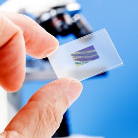 Gewebeprobe aus einer Biopsie