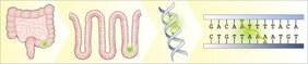  Escherichia coli-Bakterien nisten sich in Einstülpungen des Darmepithels ein. Sie geben einen Giftstoff in die Epithelzellen ab, der an die DNA-Stränge der Zellen bindet und sie miteinander verknüpft. 