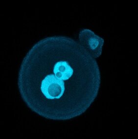 Die befruchtete Eizelle einer Maus Gene Stummschaltung