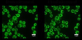 Das Ded1p-Protein der Backhefe geht von einem diffusen Zustand (nichtgestresste grüne Zellen, links) in einen Zustand über in dem es dichte Strukturen (Hitze-gestresste grüne Zellen, rechts) bildet. Der Übergang erfolgt durch den Prozess der Phasentrennung 