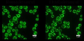 Das Ded1p-Protein der Backhefe geht von einem diffusen Zustand (nichtgestresste grüne Zellen, links) in einen Zustand über in dem es dichte Strukturen (Hitze-gestresste grüne Zellen, rechts) bildet. Der Übergang erfolgt durch den Prozess der Phasentrennung 