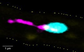 Ein einzelnes Blutplättchen bildet entzündungsfördernde PITTs in einem entzündeten Blutgefäß. Ein einzelnes Blutplättchen bildet entzündungsfördernde PITTs in einem entzündeten Blutgefäß.