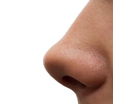 Nase