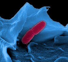 Die Halbwertszeit von RNA in Salmonellen ist dreimal kürzer als erwartet RNA in Salmonellen